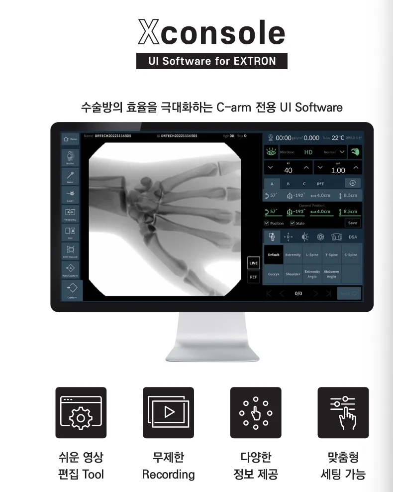수술용 저선량 C-arm 장비 소프트웨어 (X-Console) 화면