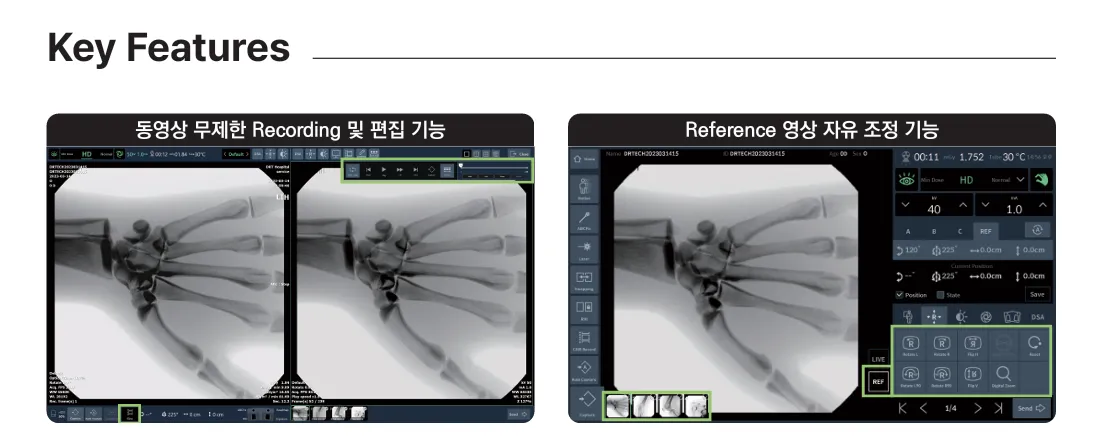 수술용 저선량 C-arm 장비 소프트웨어 (X-Console) 화면